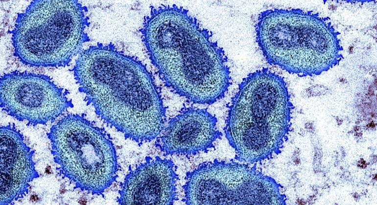 La variole du singe n'est pas actuellement une urgence de santé publique mondiale, selon l’OMS